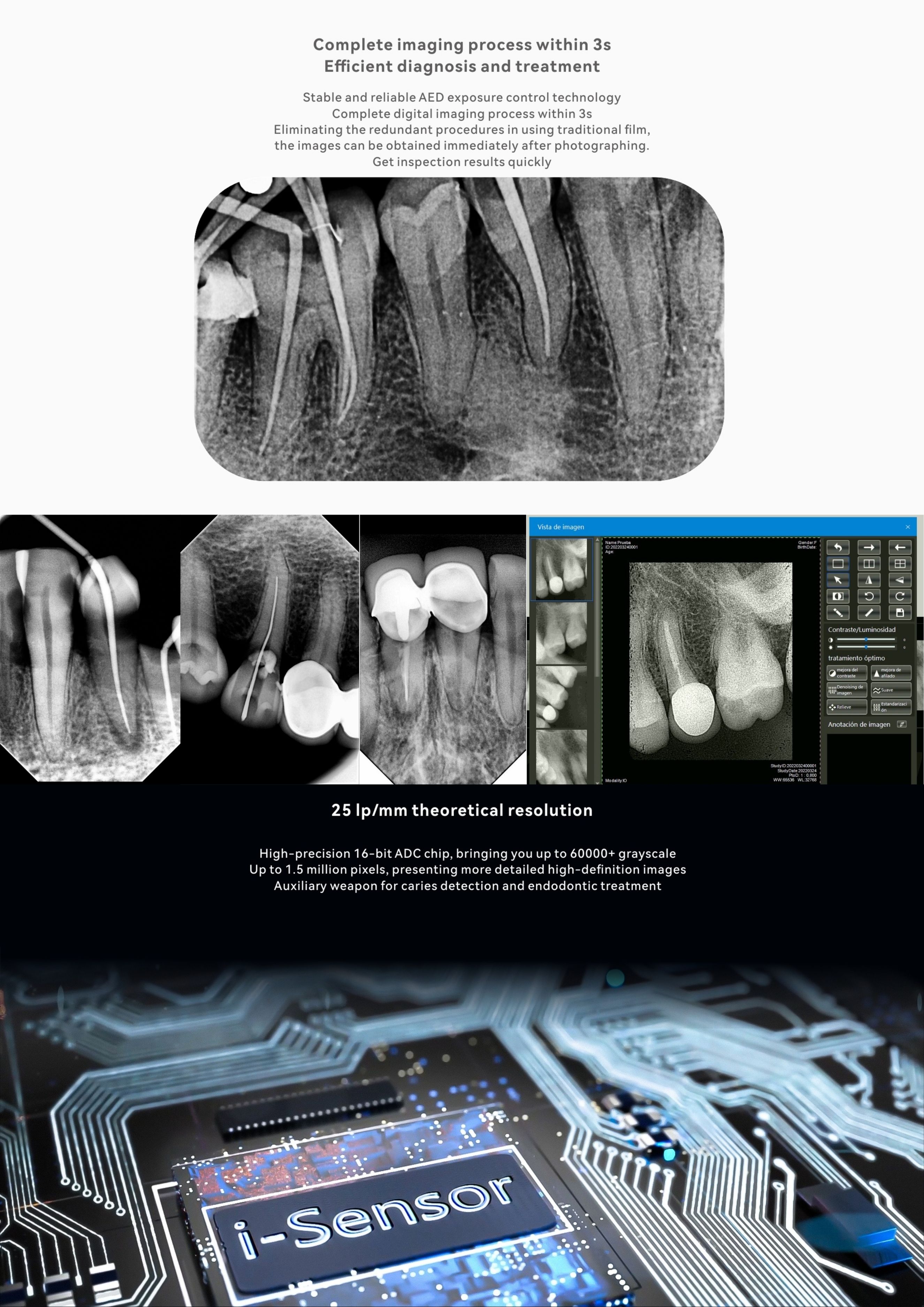 Paquete Rayos X Dental Portátil RXS + Radiovisiógrafo Woodpecker i-Sensor Orthosign